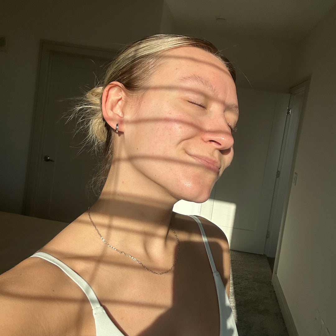 Period acne: here's why we breakout during our period.